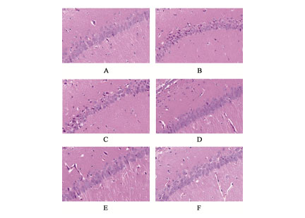 Research Progress of ZHANG Zhong-jing's Classical Formulae in Treatment of Depression