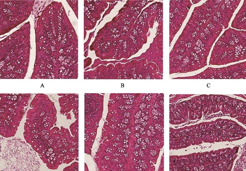 Special topic on the mechanism of Huangqin Tang in treating ulcerative colitis