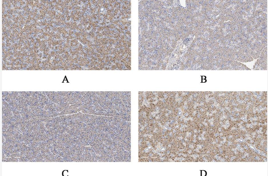 Special topics on Clinical and Basic research of Primary Sjogren's Syndrome