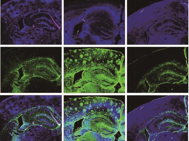 Research on Mechanism of Rehmannia Decoction for prevention and treatment of Alzheimer's disease