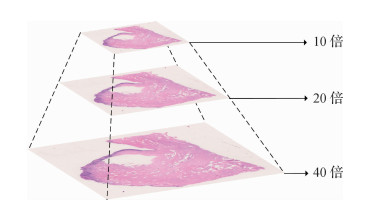 深度学习在组织病理学中的应用综述