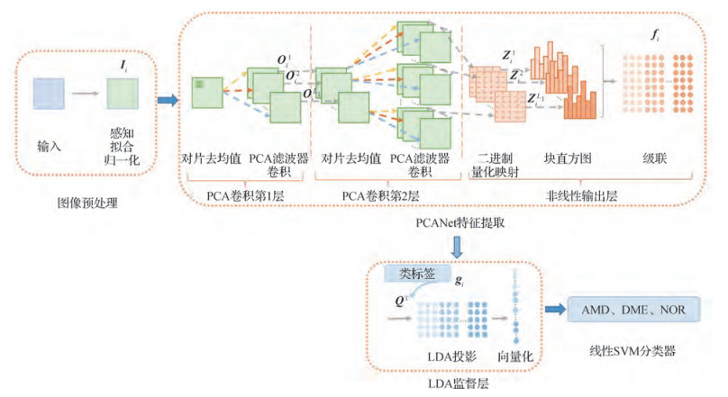 结合PCANet与线性判别分析的视网膜光学相干断层扫描图像分类