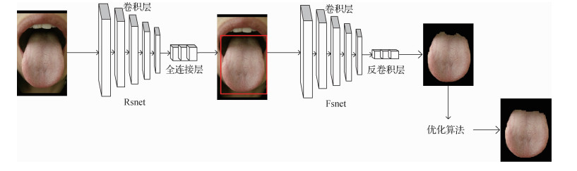 面向舌体分割的两阶段卷积神经网络设计