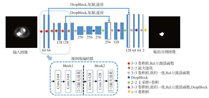 改进预训练编码器U-Net模型的PET肿瘤自动分割