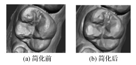 图卷积网络下牙齿种子点自动选取