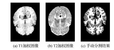 等强度婴儿脑MR图像分割的深度学习方法综述