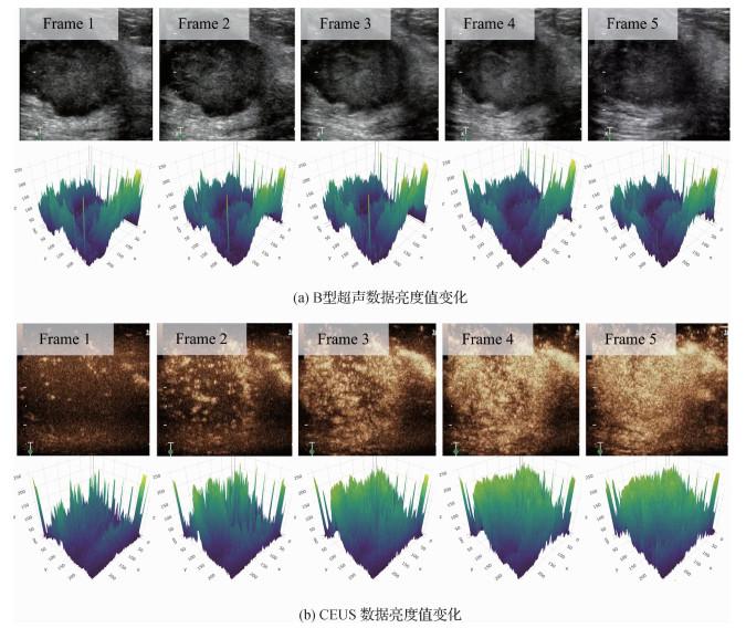 乳腺超声双模态数据的协同约束网络