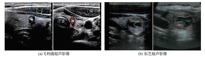 甲状腺超声影像的元优化多级对抗域适应网络