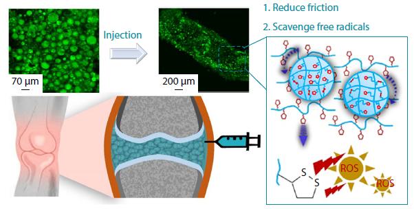 Study on Hyaluronic Acid-<italic style="font-style: italic">g</italic>-lipoic acid Microsphere-based Injectable Hydrogel for Treating Early Knee Osteoarthritis