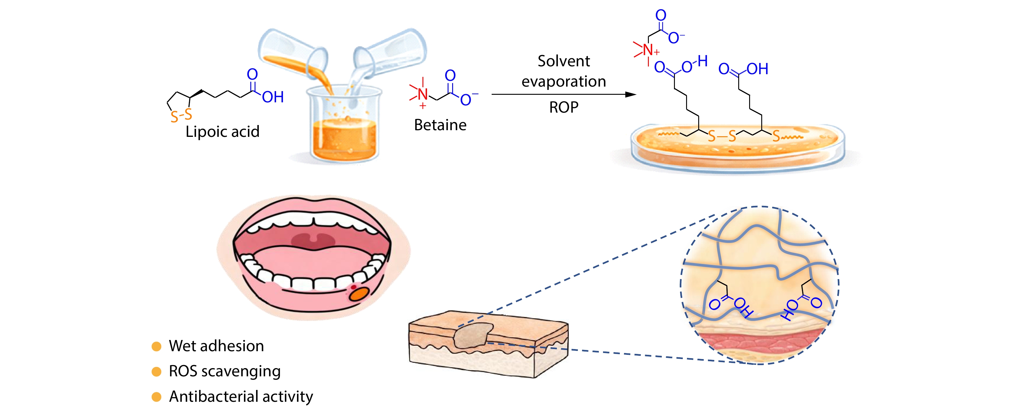 Betaine-stabilized Poly(lipoic acid) Adhesive Patch for Oral Ulcer Treatment